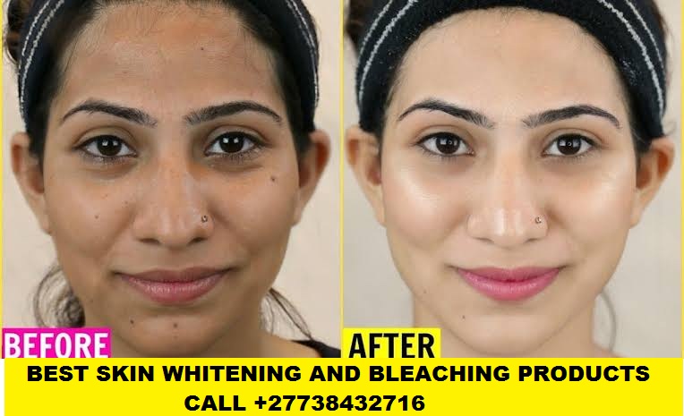 Skin Bleaching and whitening in Senagal +27738432716.jpeg