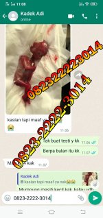 jual cytotec asli cod asli.jpg